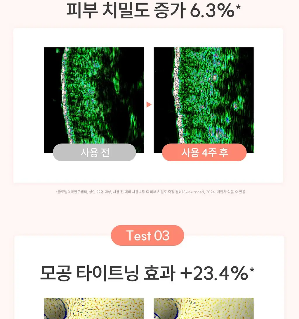 [리프팅] 아벤느 히알루론 액티브 B3 안티에이징 크림 50ml 기획 (+괄사+크림 2ml*2) 상세페이지 20